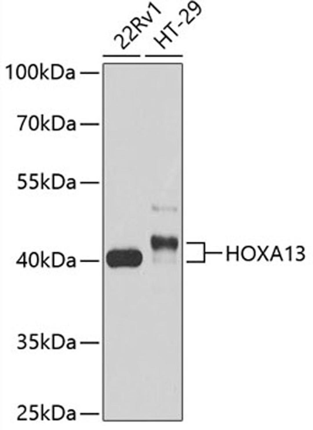 Western blot - HOXA13 antibody (A13999)