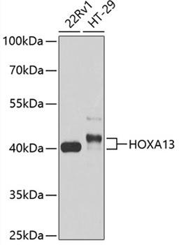 Western blot - HOXA13 antibody (A13999)