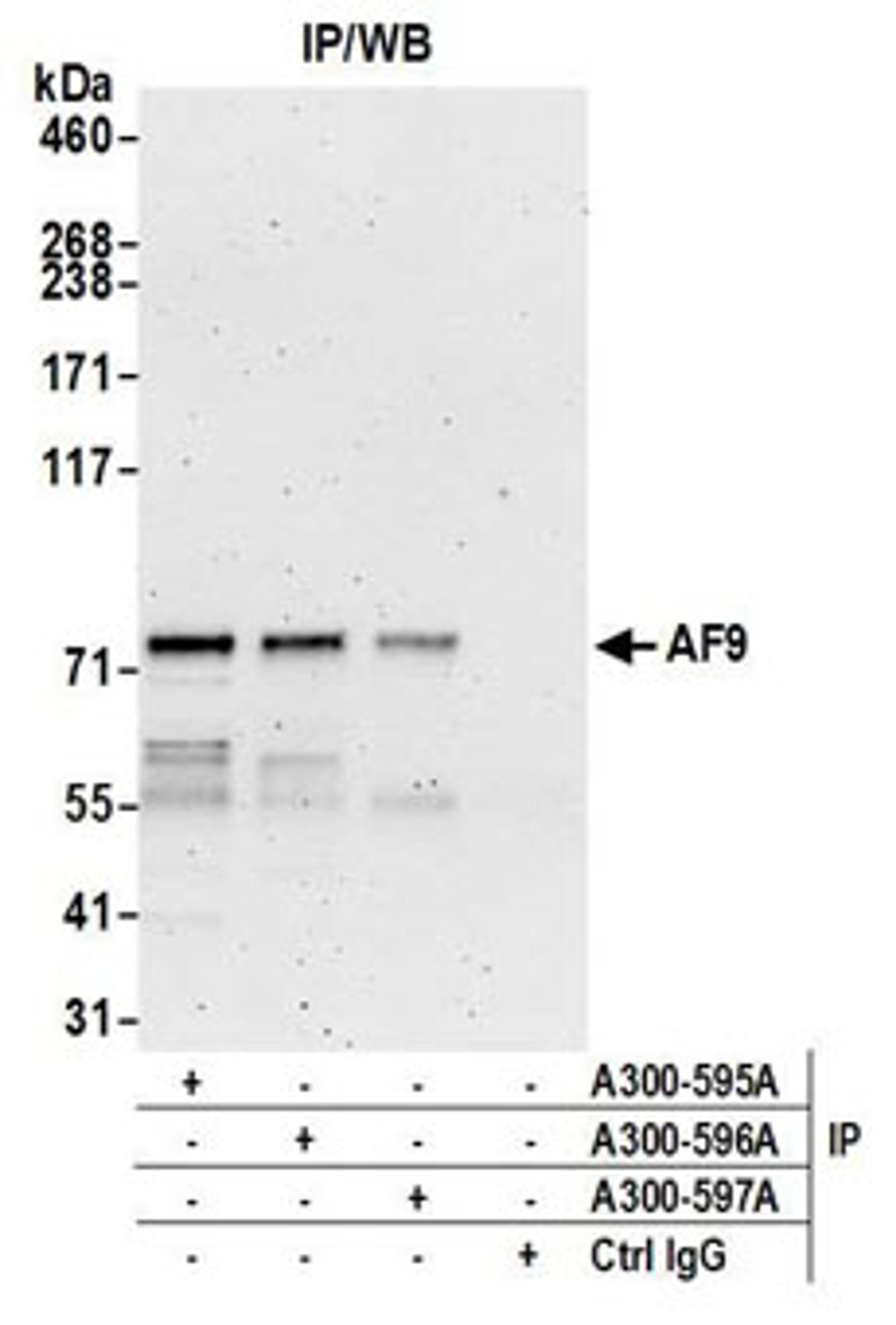 Detection of Human AF9 by Western Blot of Immunoprecipitates.