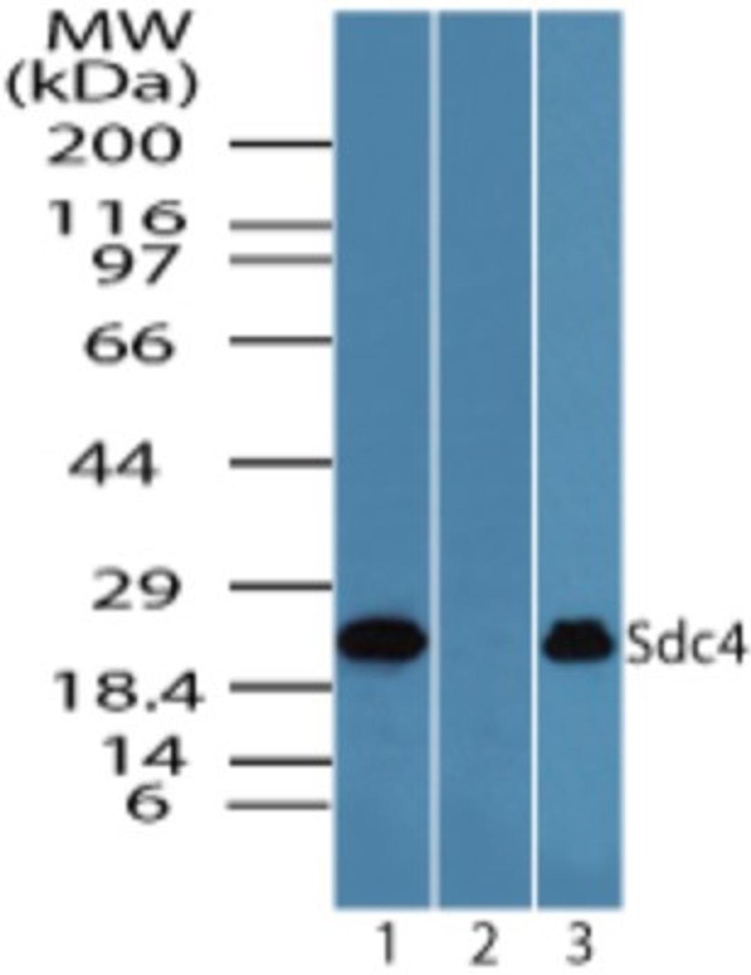 Western Blot: Syndecan 4 Antibody [NBP2-24630] - Western blot analysis of Syndecan 4 in Jurkat cell lysate in the 1) absence and 2) presence of immunizing peptide and 3) Raw cell lysate using NBP2-24630 at 1.0 ug/ml.