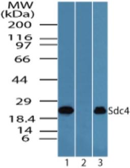 Western Blot: Syndecan 4 Antibody [NBP2-24630] - Western blot analysis of Syndecan 4 in Jurkat cell lysate in the 1) absence and 2) presence of immunizing peptide and 3) Raw cell lysate using NBP2-24630 at 1.0 ug/ml.