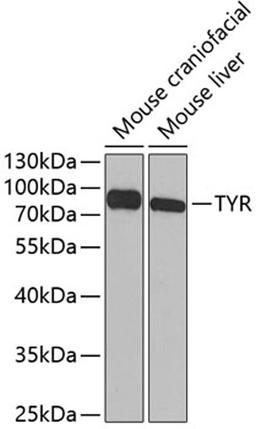 Western blot - TYR antibody (A1254)