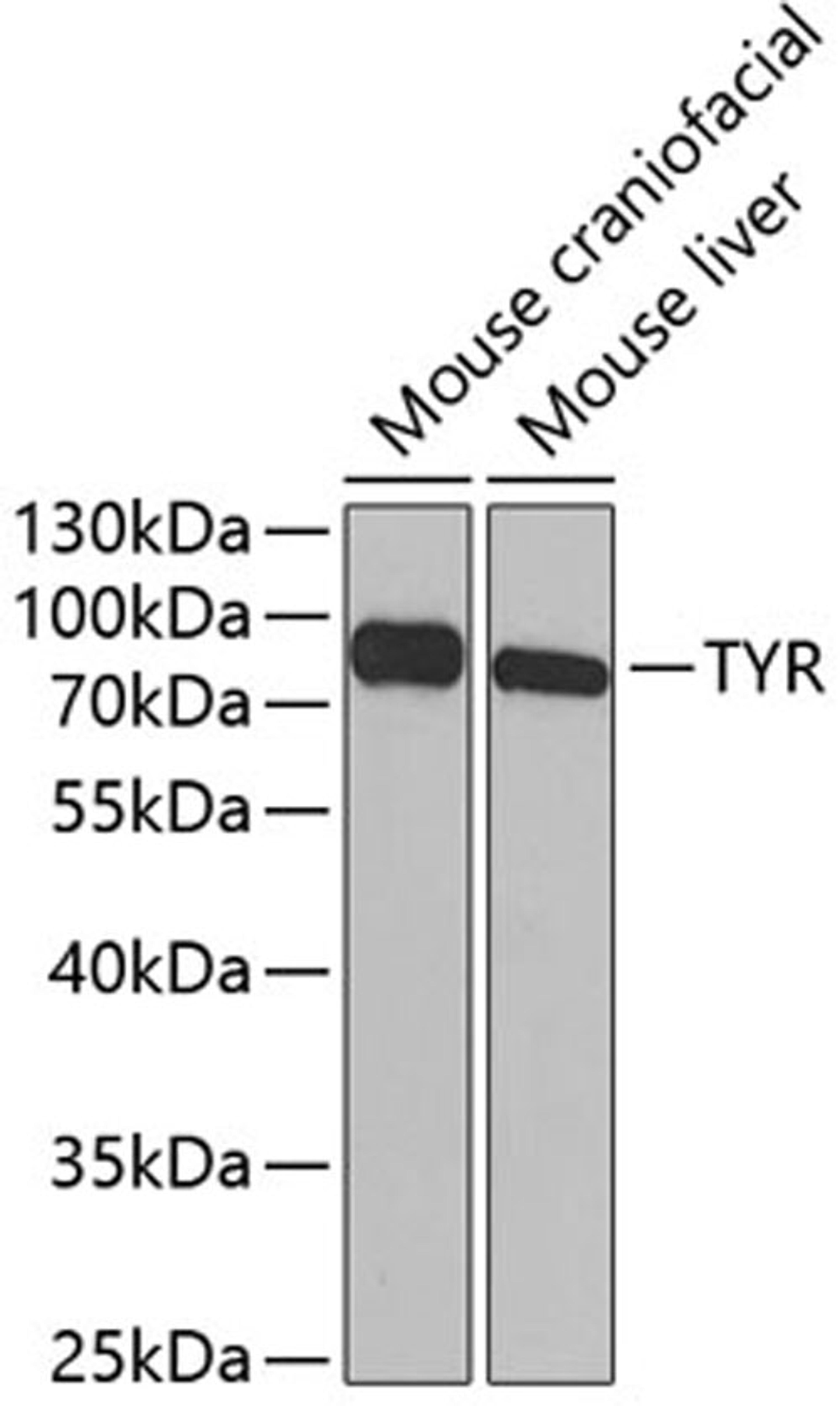 Western blot - TYR antibody (A1254)