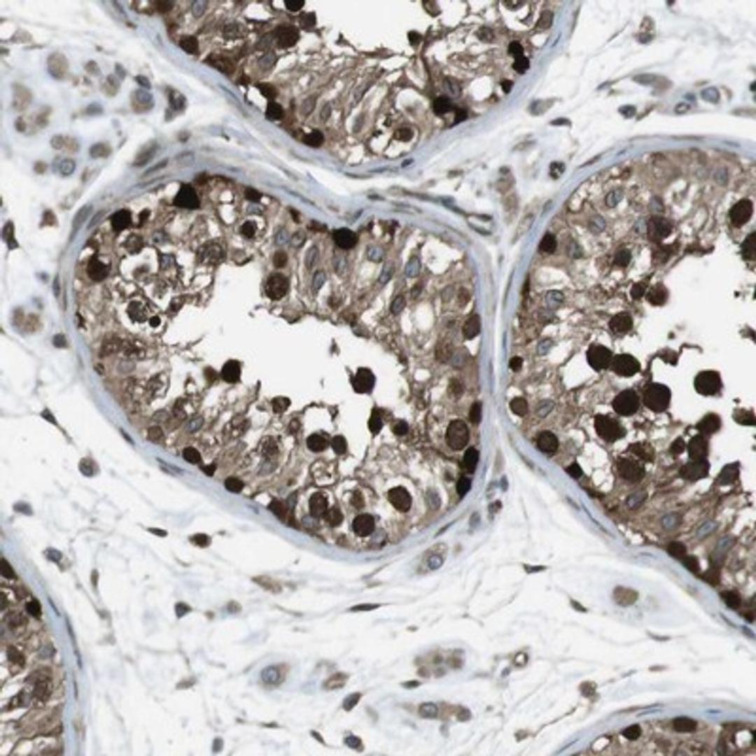 Immunohistochemistry-Paraffin: ZNF330 Antibody [NBP1-81694] - Staining of human testis shows strong nuclear and cytoplasmic positivity in cells in seminiferus ducts.