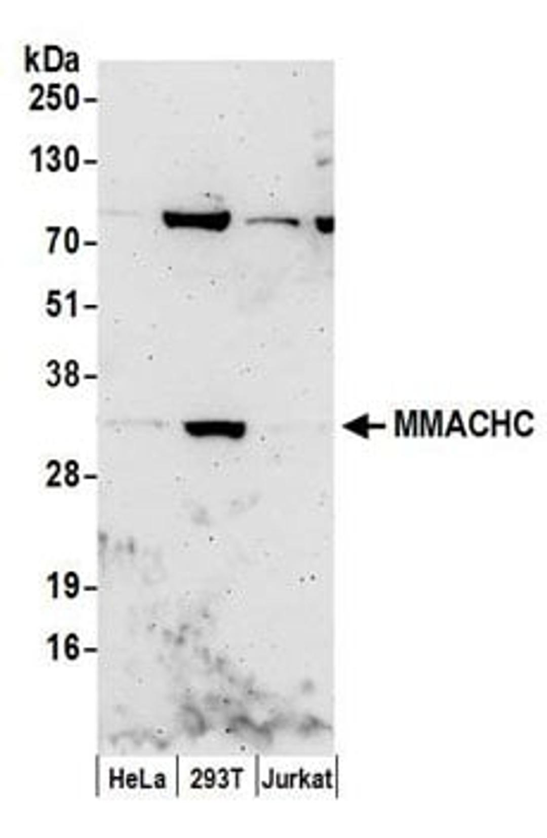 Detection of human MMACHC by western blot.