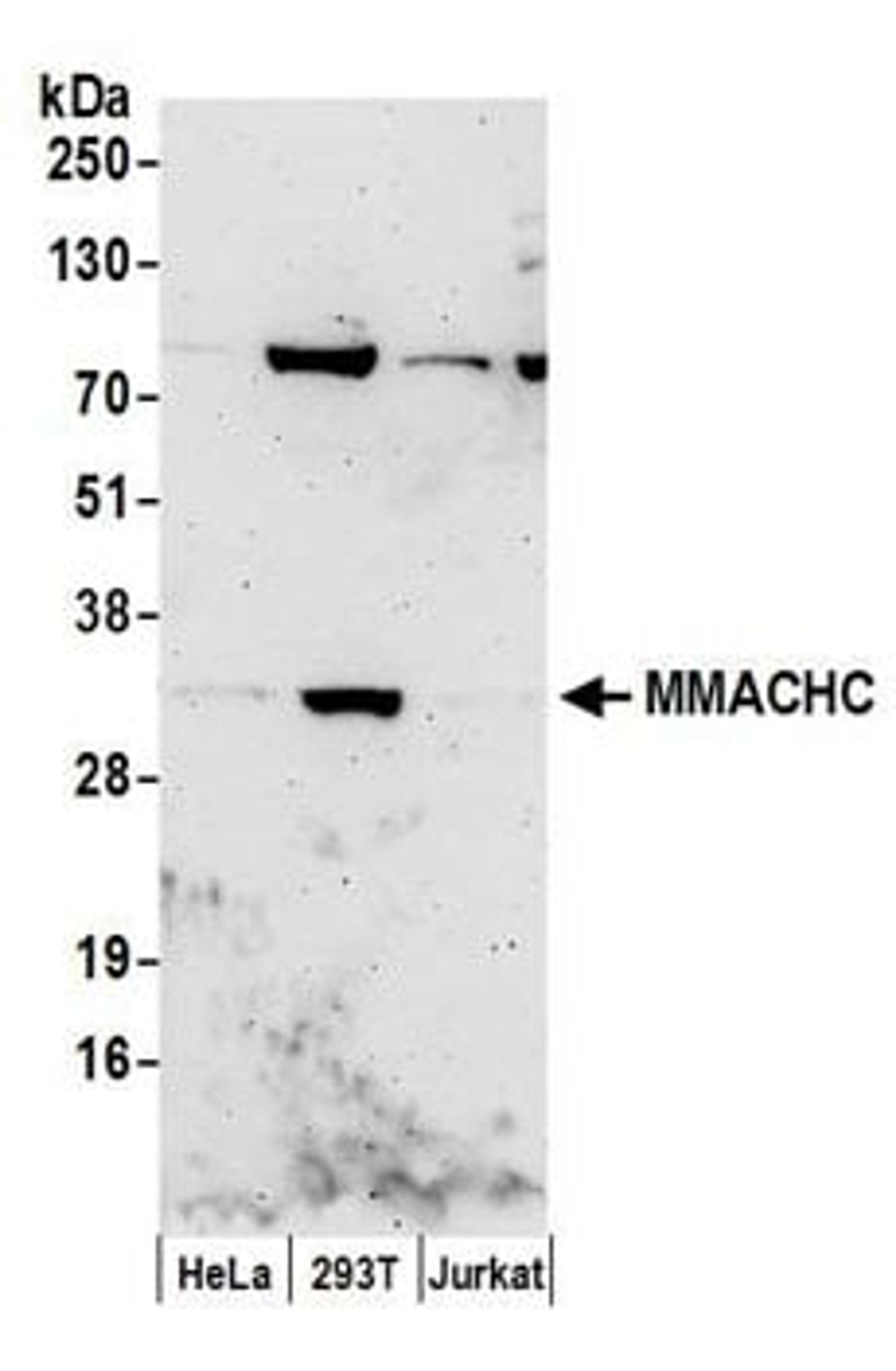 Detection of human MMACHC by western blot.