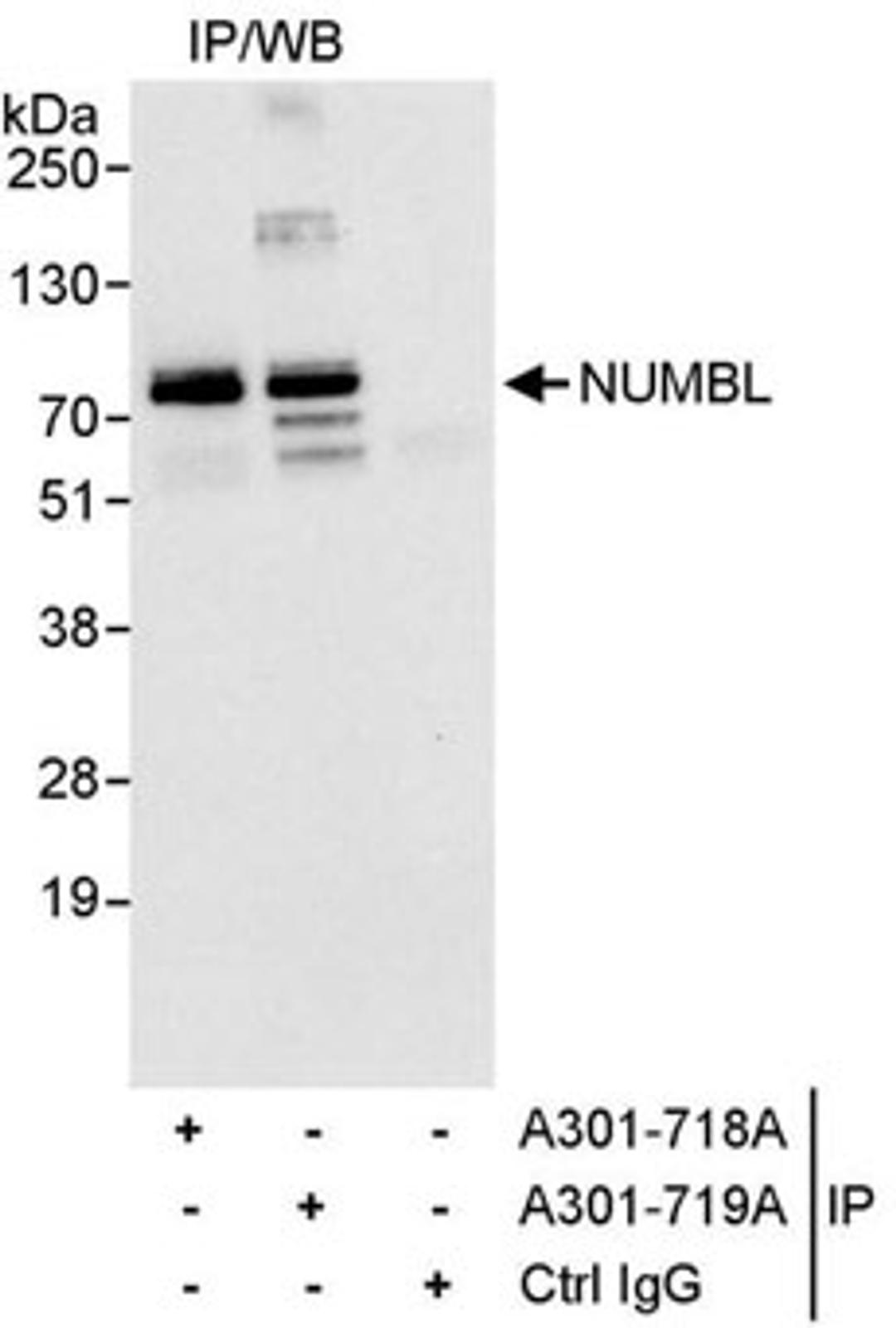 Detection of human NUMBL1 by western blot of immunoprecipitates.