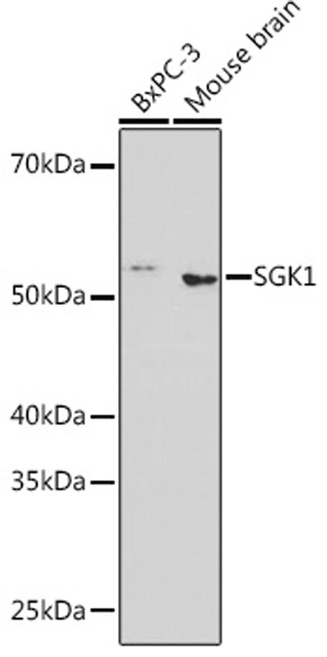 Western blot - SGK1 Rabbit mAb (A3936)