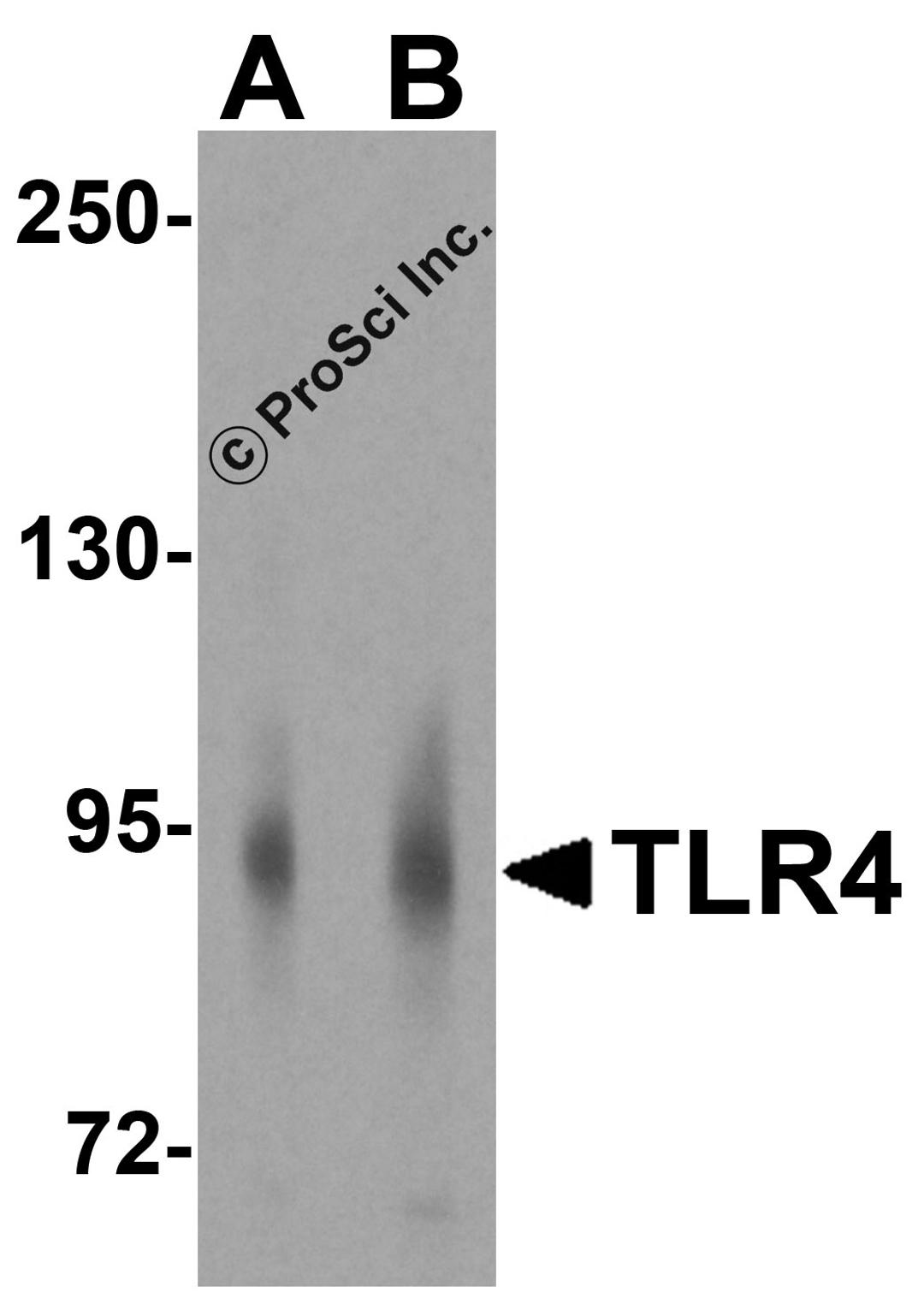 Western blot analysis of TLR4 in human small intestine lysate with TLR4 antibody at (A) 2 and (B) 4 μg/mL.