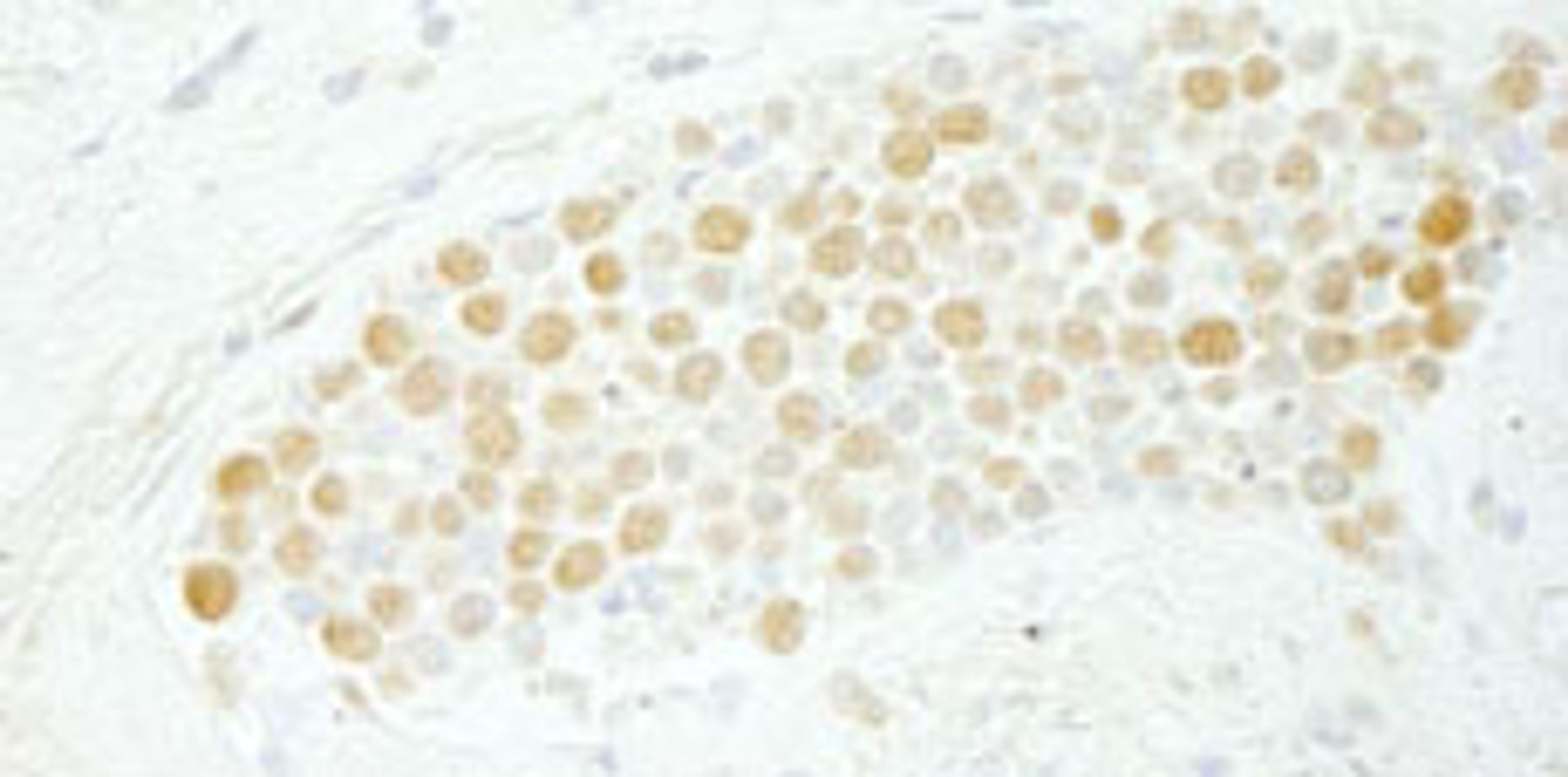 Detection of human CDC5L by immunohistochemistry.