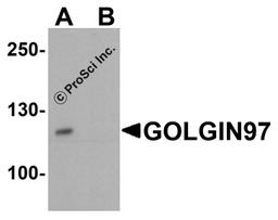 Western blot analysis of GOLGIN97 in human stomach tissue lysate with GOLGIN97 antibody at 1 μg/ml in (A) the absence and (B) the presence of blocking petpide.