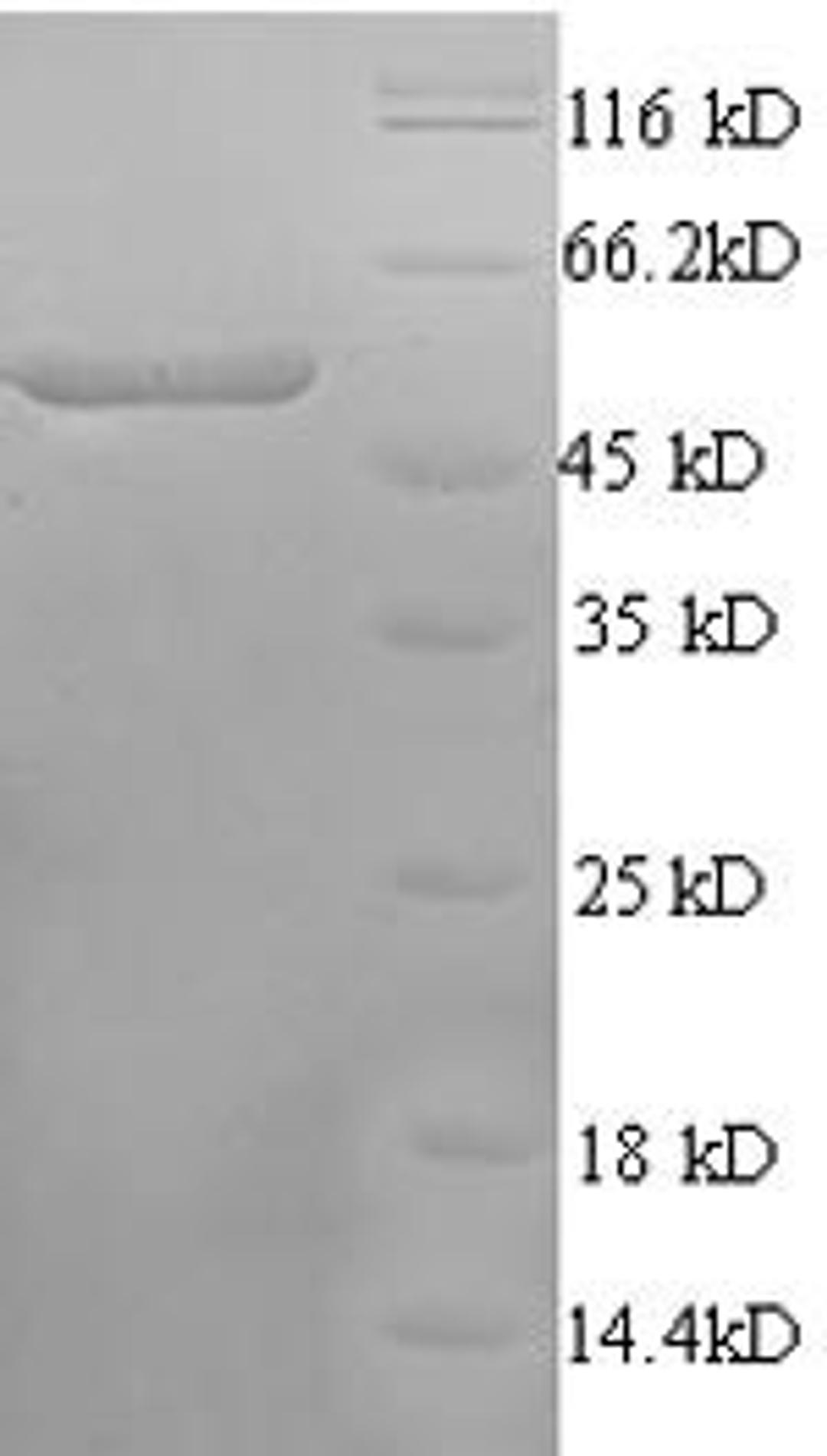 (Tris-Glycine gel) Discontinuous SDS-PAGE (reduced) with 5% enrichment gel and 15% separation gel.