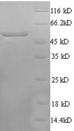(Tris-Glycine gel) Discontinuous SDS-PAGE (reduced) with 5% enrichment gel and 15% separation gel.