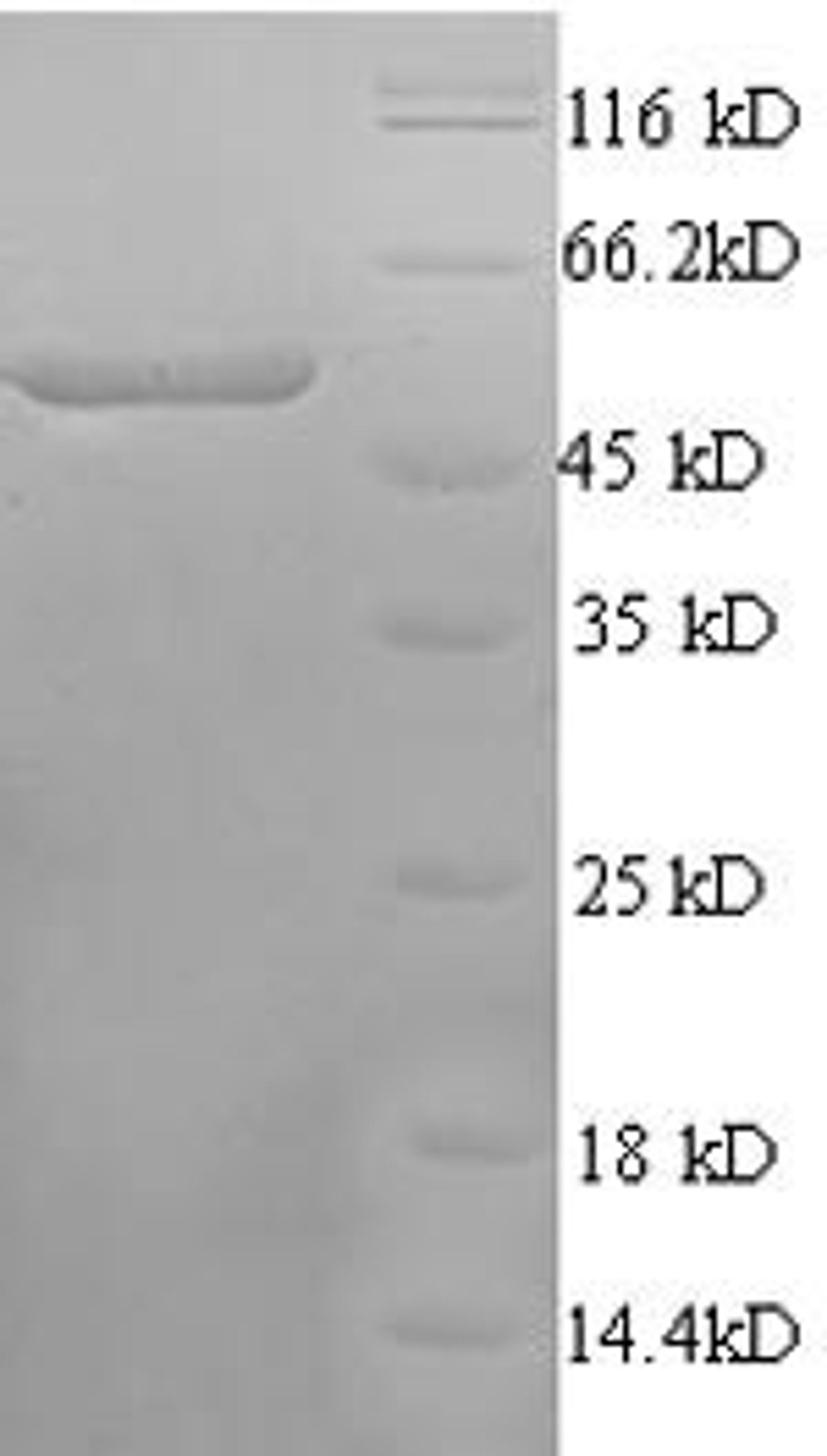 (Tris-Glycine gel) Discontinuous SDS-PAGE (reduced) with 5% enrichment gel and 15% separation gel.