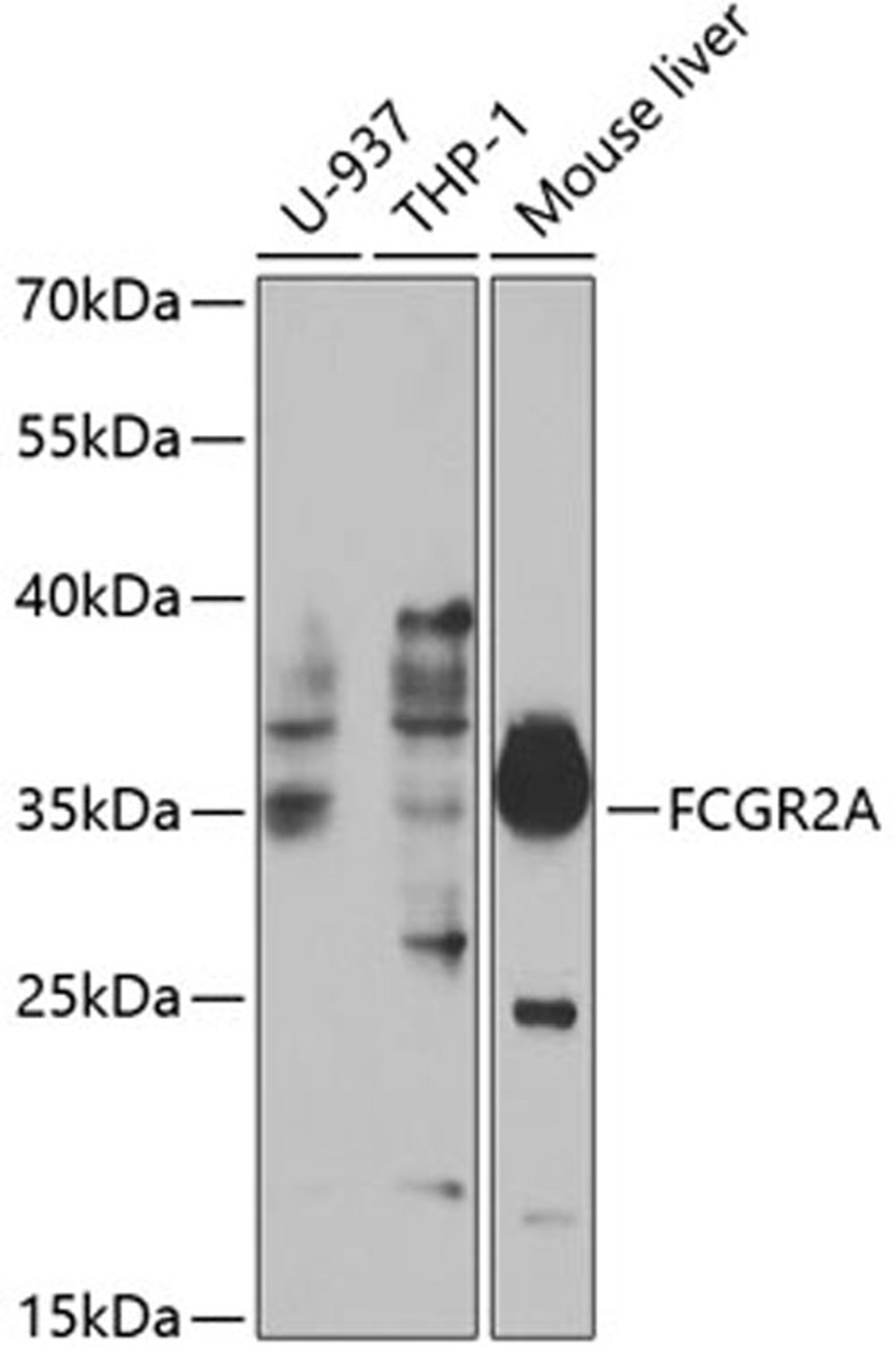 Western blot - FCGR2A antibody (A1388)