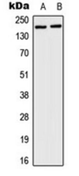 Western blot analysis of HeLa (Lane 1), mouse brain (Lane 2) whole cell lysates using HCFC1 antibody