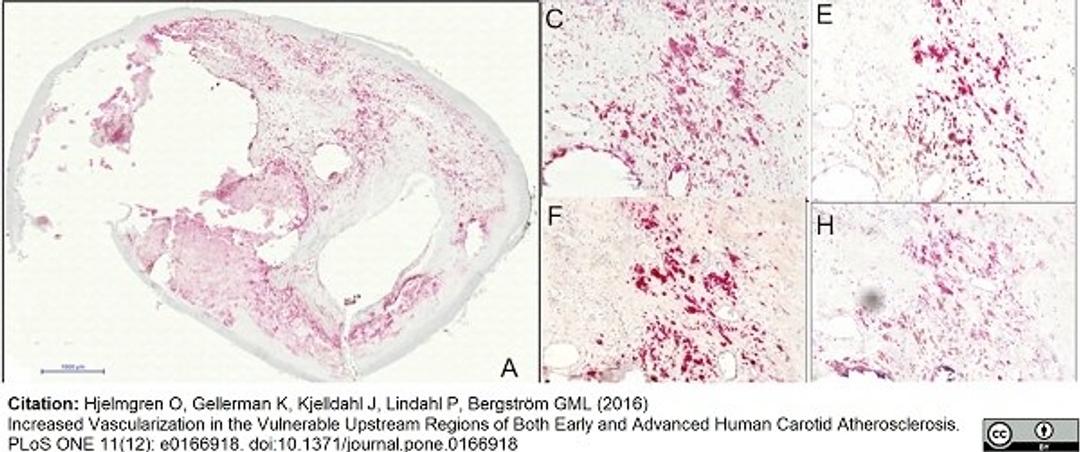 Goat anti Human VEGF antibody used for the identification of VEGF expressing cells