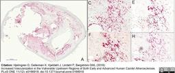 Goat anti Human VEGF antibody used for the identification of VEGF expressing cells