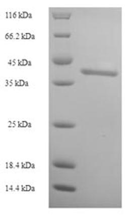 (Tris-Glycine gel) Discontinuous SDS-PAGE (reduced) with 5% enrichment gel and 15% separation gel.