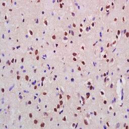 Immunohistochemical analysis of formalin-fixed paraffin embedded rat brain tissue using Cux2 antibody