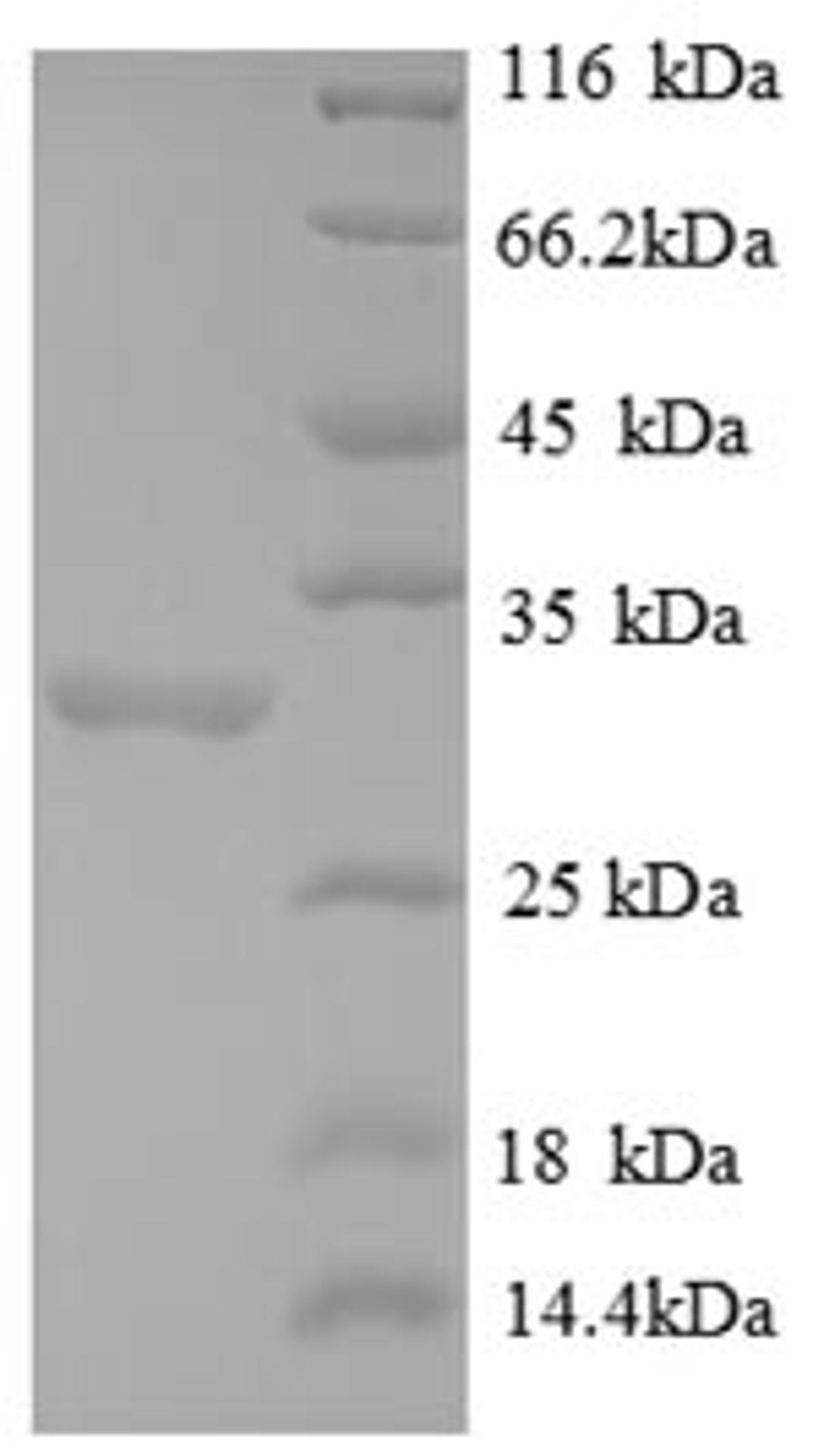 (Tris-Glycine gel) Discontinuous SDS-PAGE (reduced) with 5% enrichment gel and 15% separation gel.