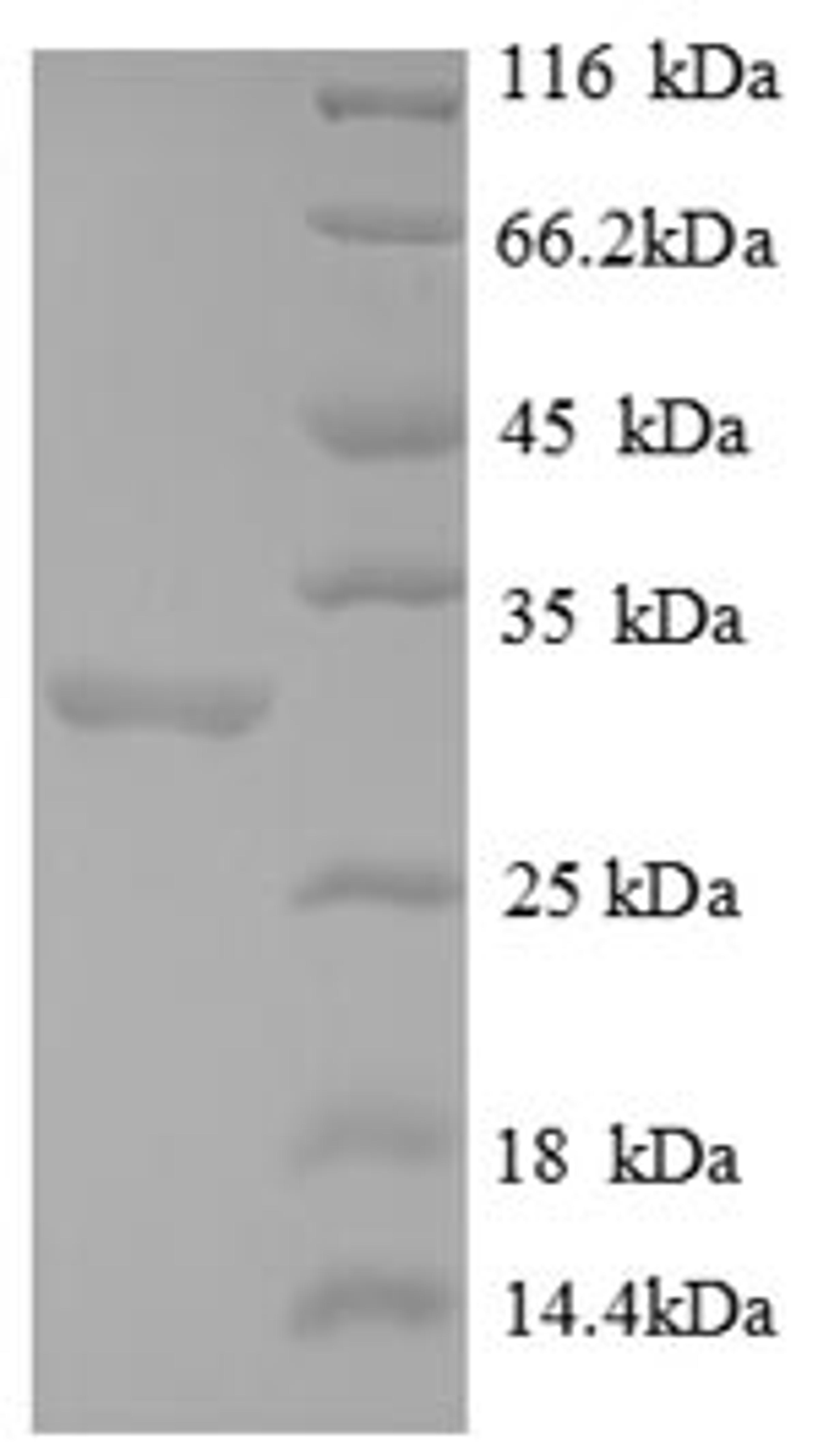(Tris-Glycine gel) Discontinuous SDS-PAGE (reduced) with 5% enrichment gel and 15% separation gel.