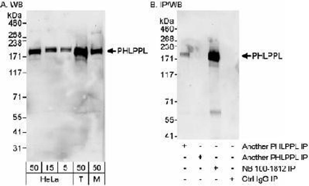 Western Blot: PHLPP2 Antibody [NB100-1812] - Detection of Human and Mouse PHLPPL on HeLa whole cell lysate using NB100-1812. PHLPPL was also IPed, albeit less efficiently, using another rabbit anti-PHLPPL antibody.