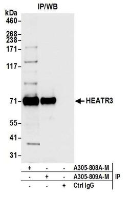 Detection of human HEATR3 by WB of IP.