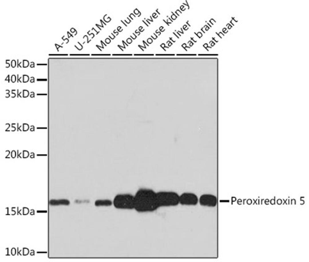 Western blot - Peroxiredoxin 5 Rabbit mAb (A3954)