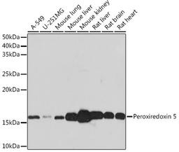 Western blot - Peroxiredoxin 5 Rabbit mAb (A3954)