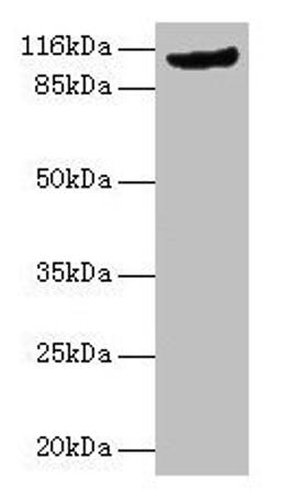 Western blot. All lanes: MVP antibody at 2µg/ml + Rat lung tissue. Secondary. Goat polyclonal to rabbit IgG at 1/10000 dilution. Predicted band size: 100 kDa. Observed band size: 110 kDa
