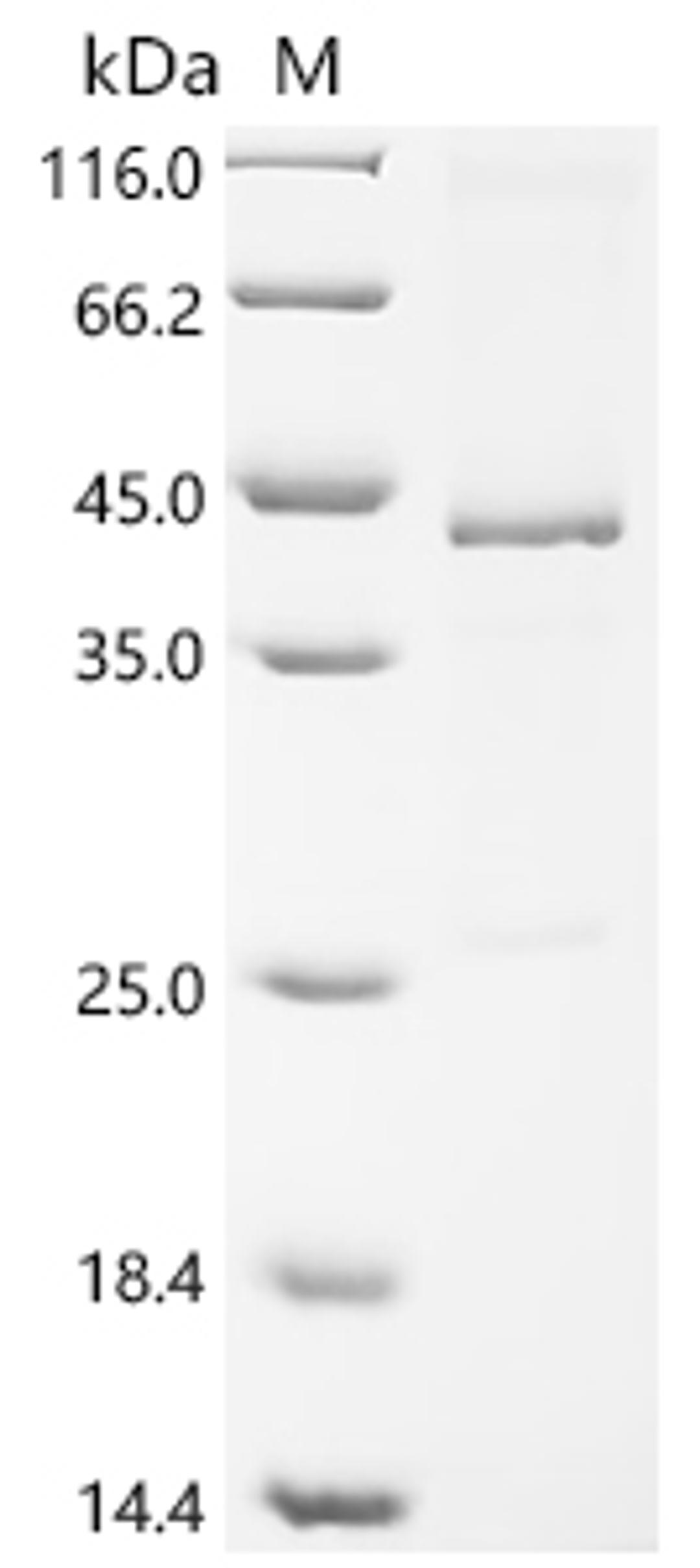 (Tris-Glycine gel) Discontinuous SDS-PAGE (reduced) with 5% enrichment gel and 15% separation gel.