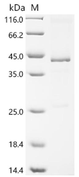 (Tris-Glycine gel) Discontinuous SDS-PAGE (reduced) with 5% enrichment gel and 15% separation gel.