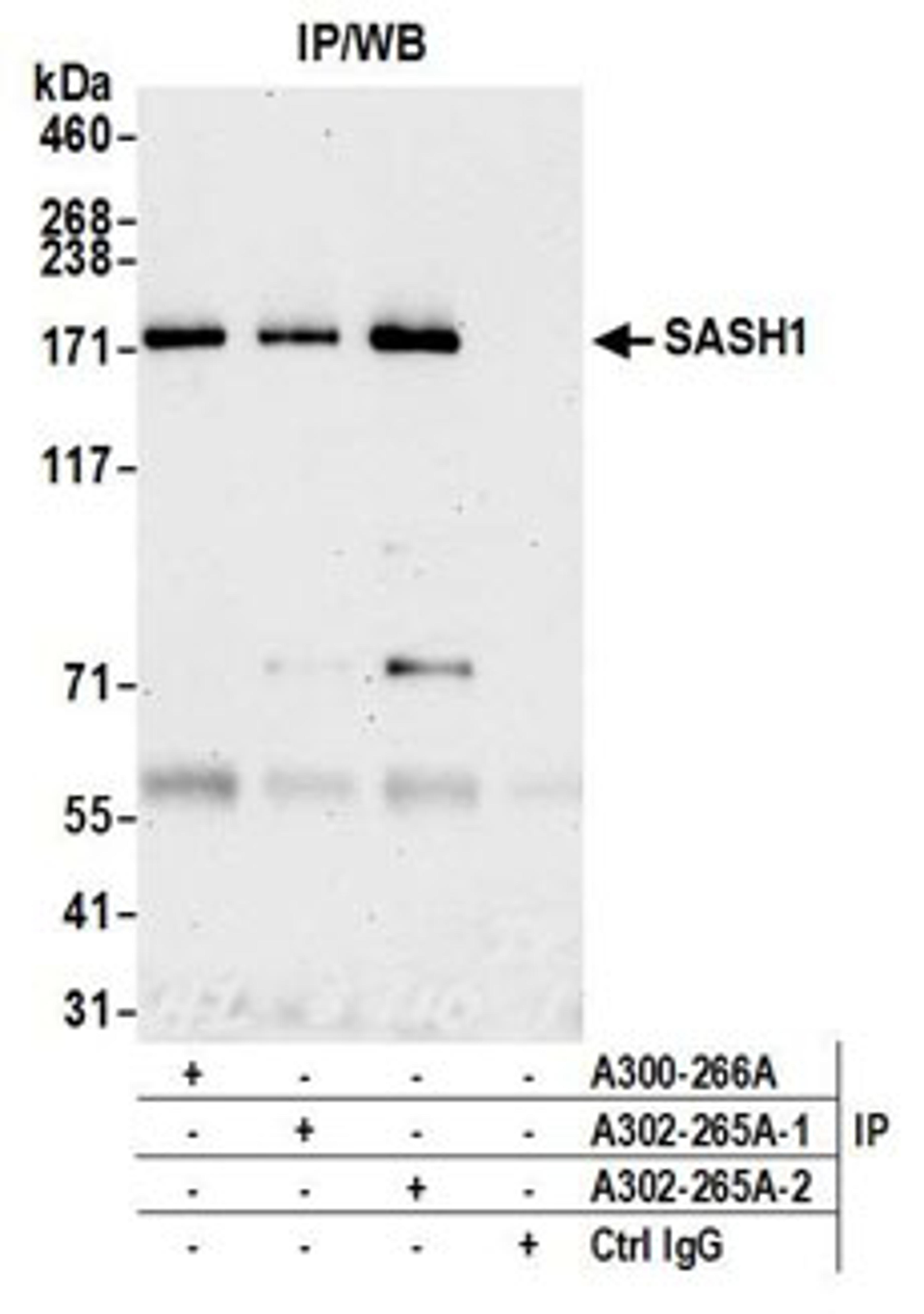 Detection of human SASH1 by western blot of immunoprecipitates.