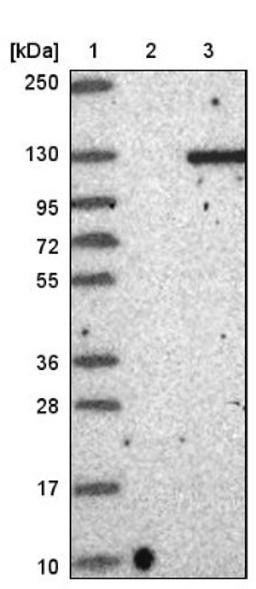 Immunohistochemistry: GARNL3 Antibody [NBP1-90799] - Lane 1: Marker [kDa] 250, 130, 95, 72, 55, 36, 28, 17, 10<br/>Lane 2: Negative control (vector only transfected HEK293T lysate)<br/>Lane 3: Over-expression lysate (Co-expressed with a C-terminal myc-DDK tag (~3.1 kDa) in mammalian HEK293T cells, LY410236)