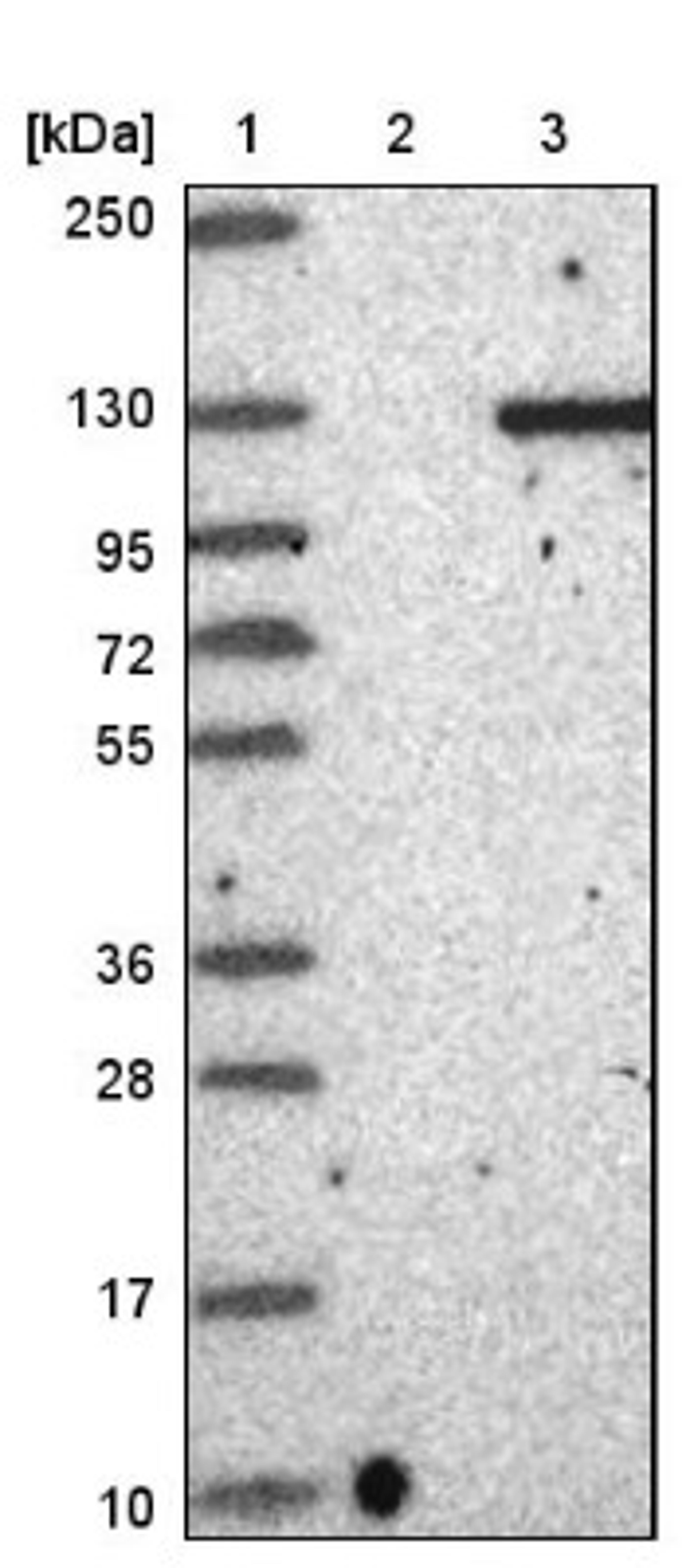 Immunohistochemistry: GARNL3 Antibody [NBP1-90799] - Lane 1: Marker [kDa] 250, 130, 95, 72, 55, 36, 28, 17, 10<br/>Lane 2: Negative control (vector only transfected HEK293T lysate)<br/>Lane 3: Over-expression lysate (Co-expressed with a C-terminal myc-DDK tag (~3.1 kDa) in mammalian HEK293T cells, LY410236)