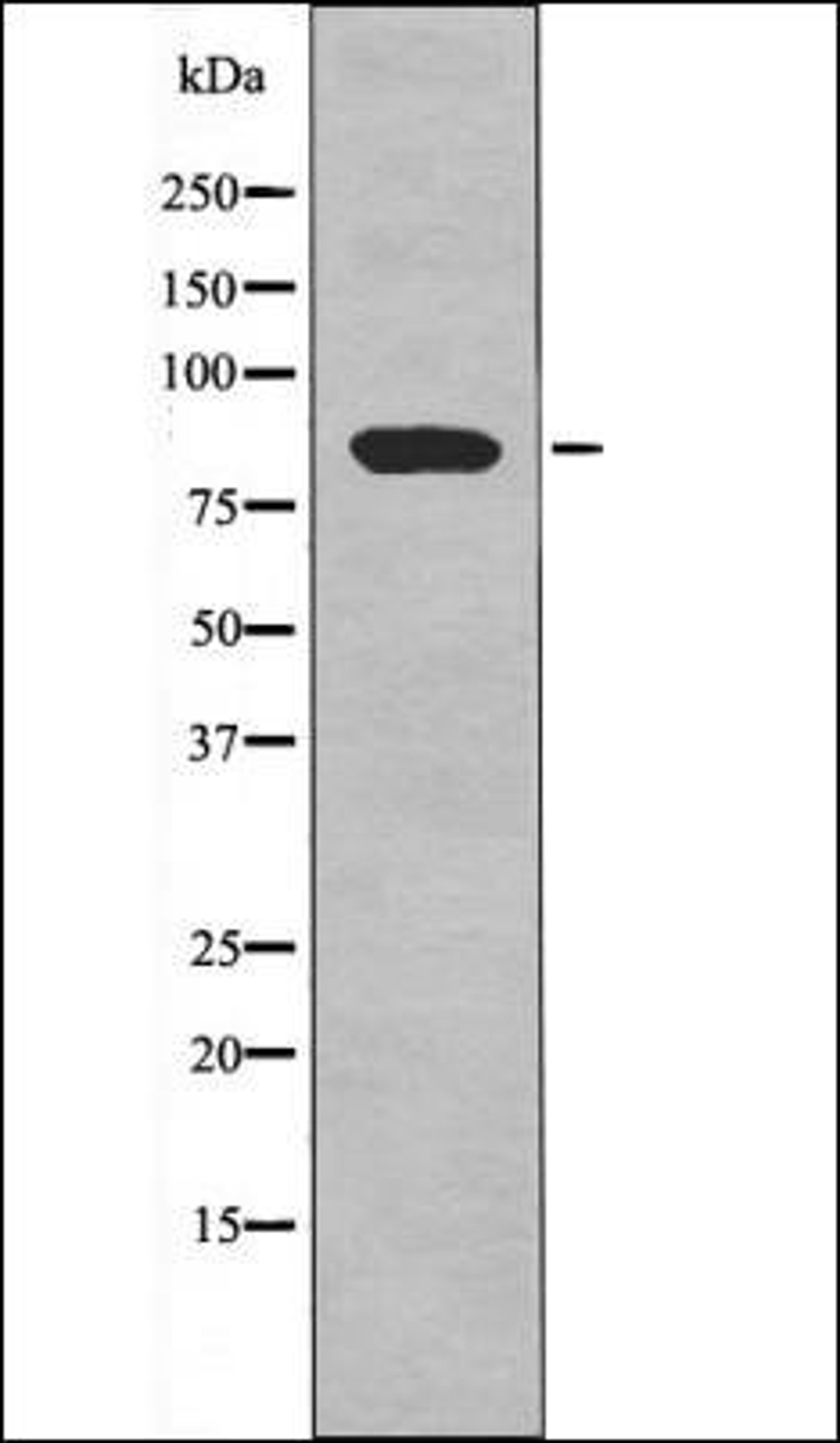 Western blot analysis of PMA treated HeLa whole cell lysates using TBK1 -Phospho-Ser172- antibody