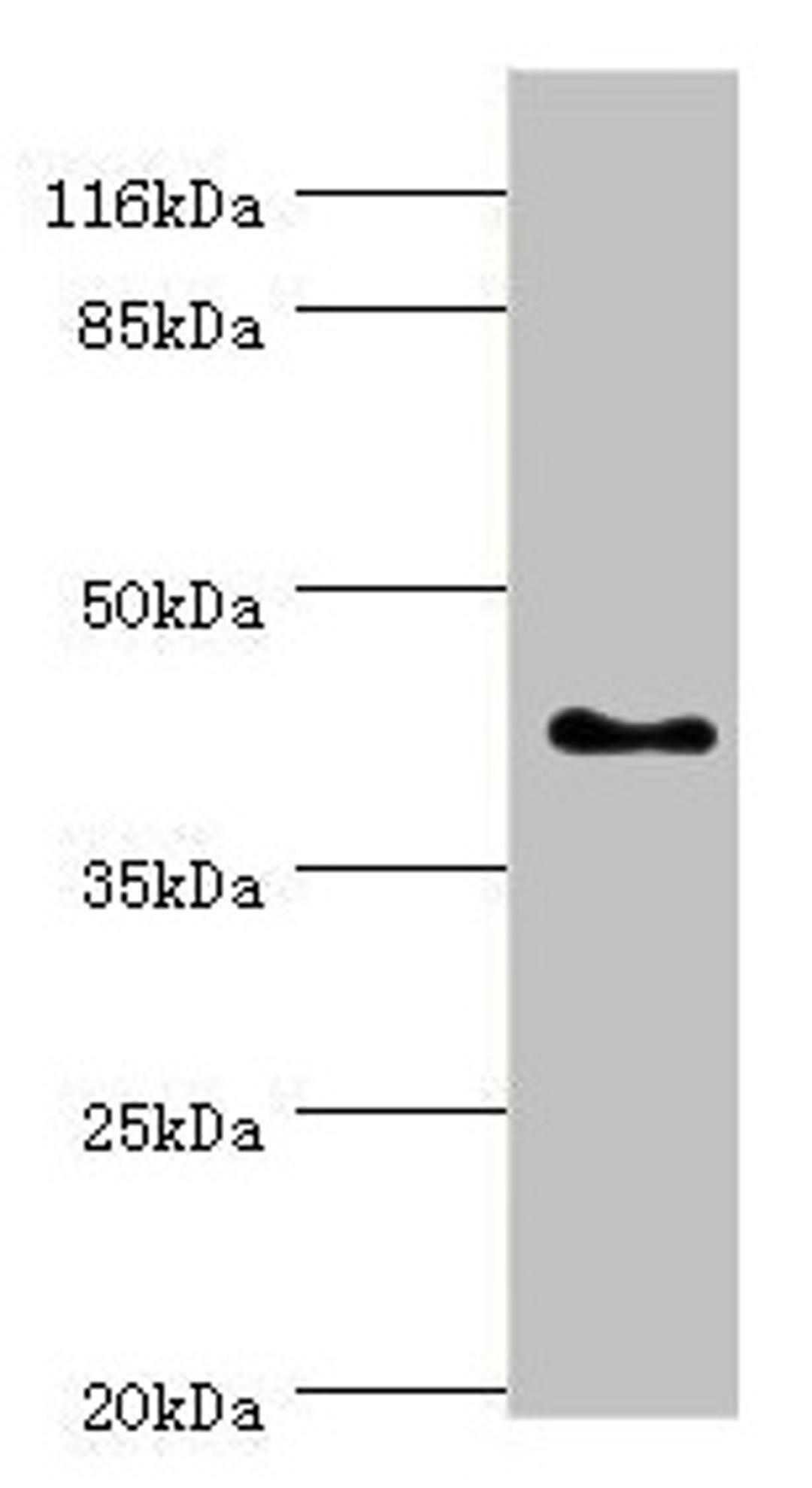 Western blot. All lanes: SH3GL2 antibody at 0.91µg/ml + HepG2 whole cell lysate. Secondary. Goat polyclonal to rabbit IgG at 1/10000 dilution. Predicted band size: 40 kDa. Observed band size: 40 kDa