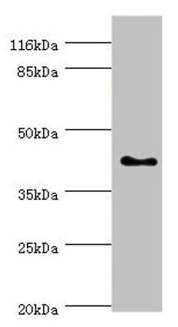 Western blot. All lanes: SH3GL2 antibody at 0.91µg/ml + HepG2 whole cell lysate. Secondary. Goat polyclonal to rabbit IgG at 1/10000 dilution. Predicted band size: 40 kDa. Observed band size: 40 kDa