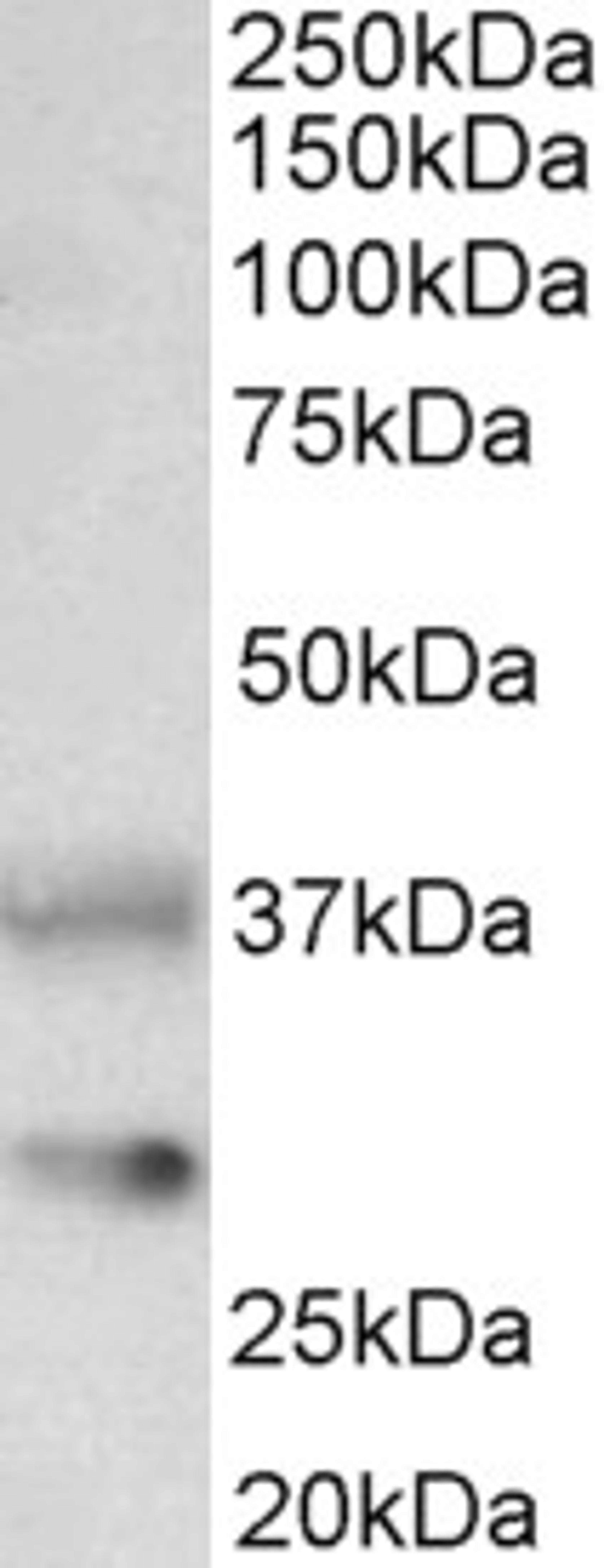 46-749 (0.1ug/ml) staining of Rat Brain lysate (35ug protein in RIPA buffer). Primary incubation was 1 hour. Detected by chemiluminescence.