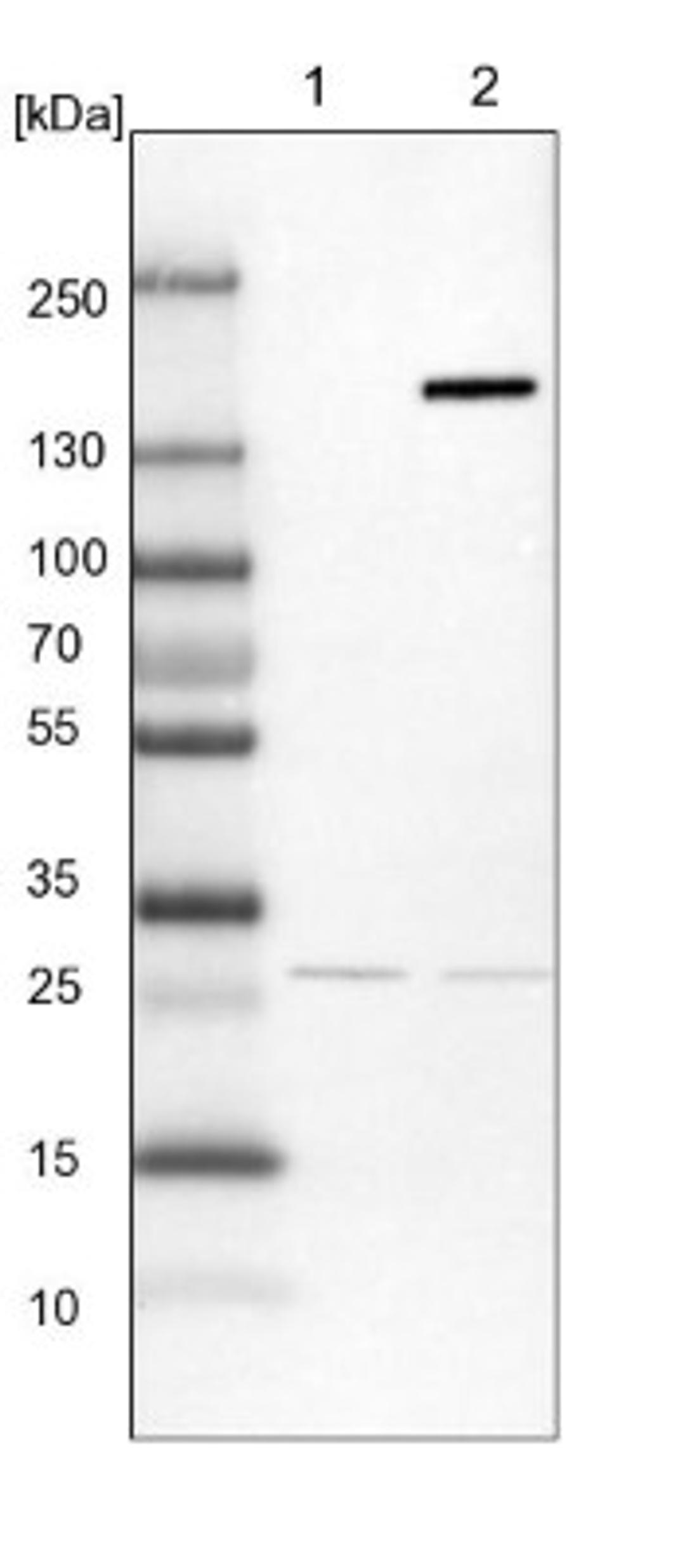 Western Blot: FAM83H Antibody [NBP1-93737] - Lane 1: NIH-3T3 cell lysate (Mouse embryonic fibroblast cells)<br/>Lane 2: NBT-II cell lysate (Rat Wistar bladder tumour cells)