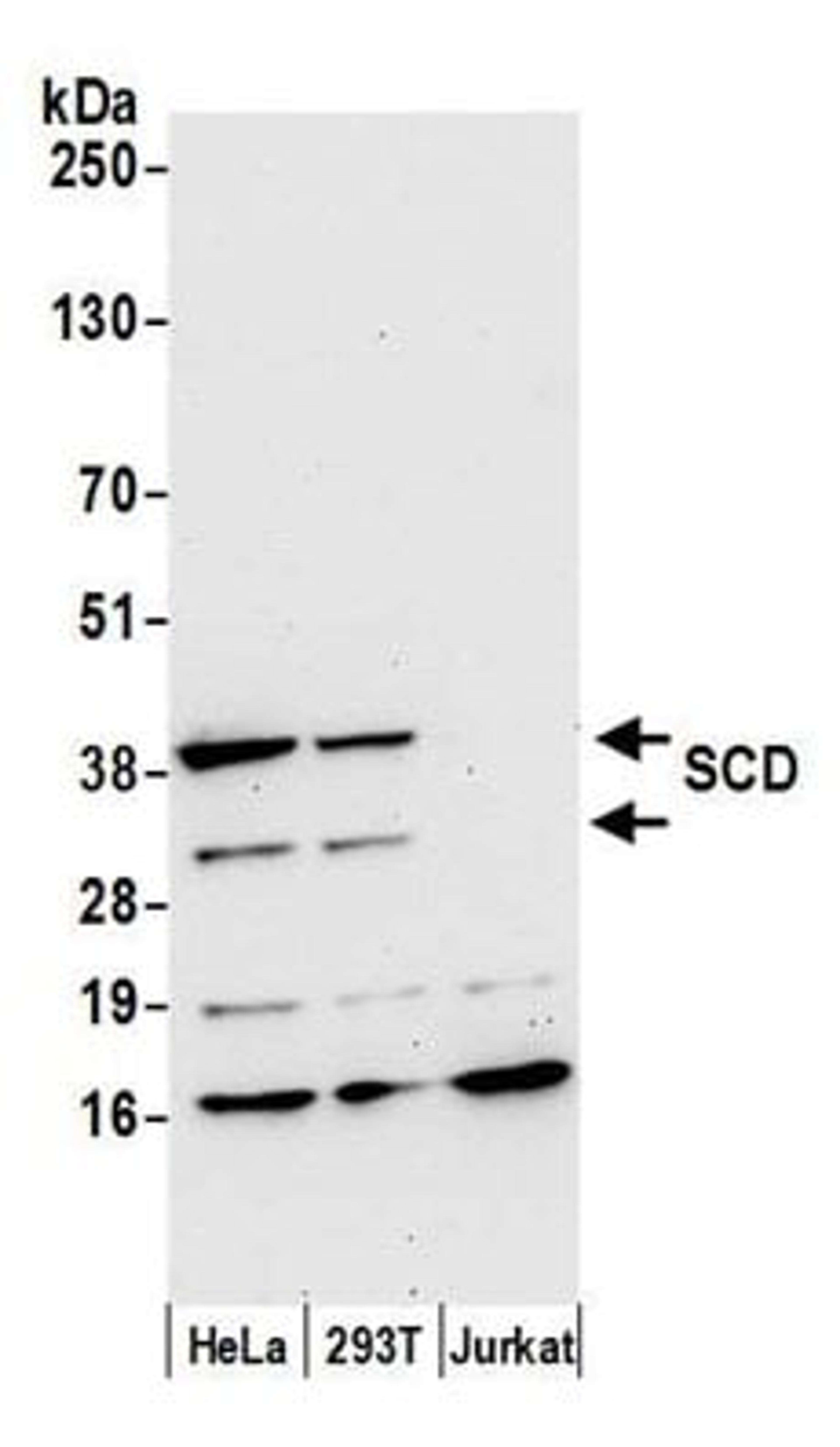 Detection of human SCD by western blot.