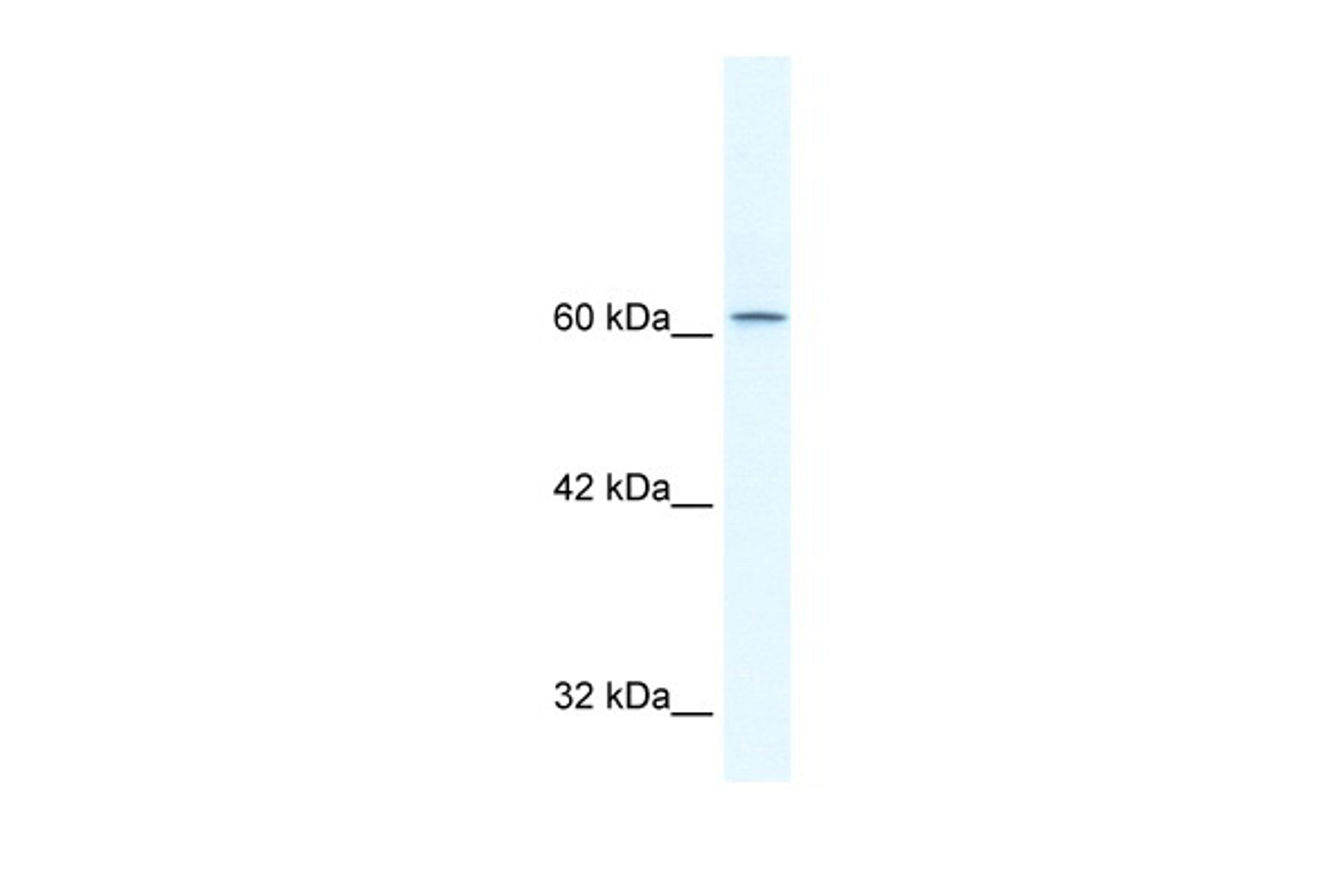 Antibody used in WB on Human HepG2 at 2.5 ug/ml.