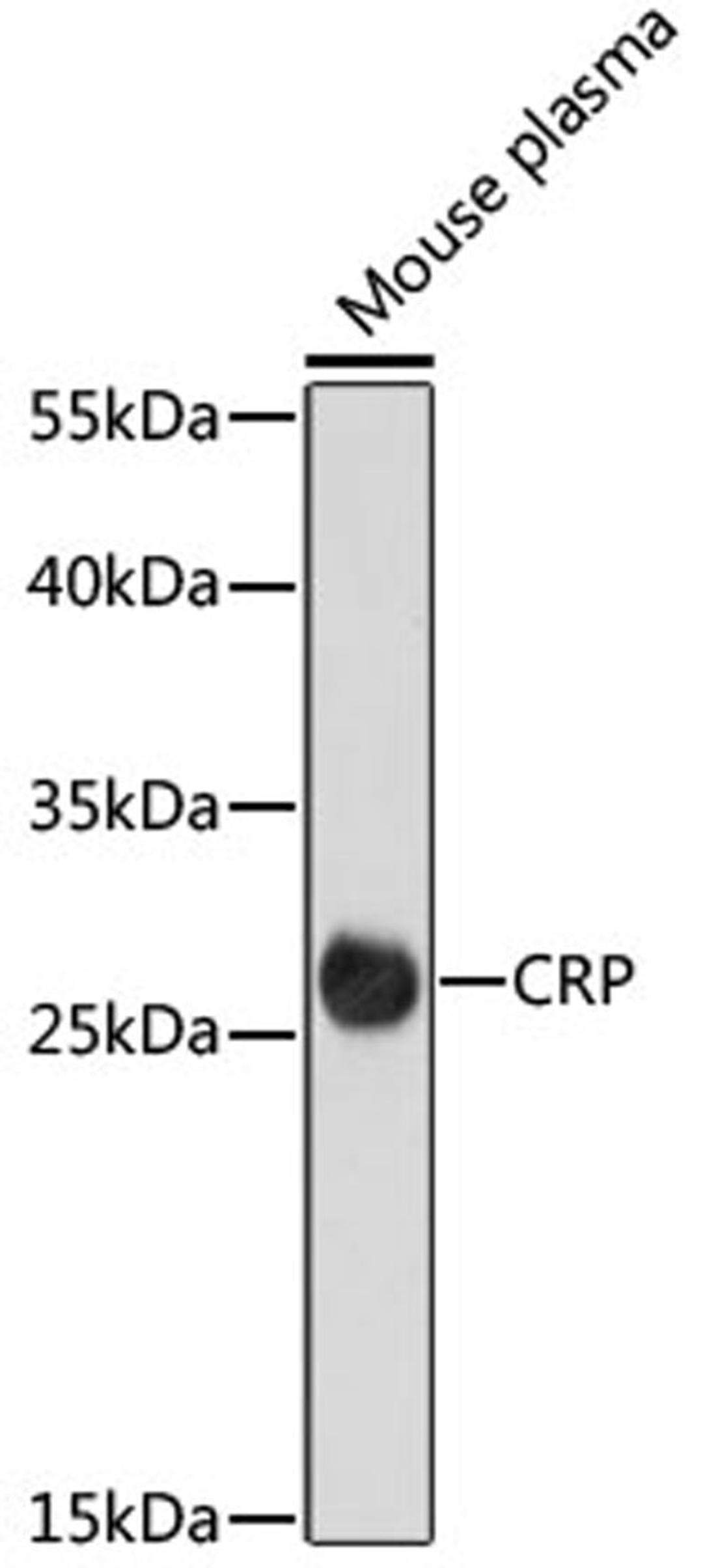 Western blot - CRP antibody (A15659)