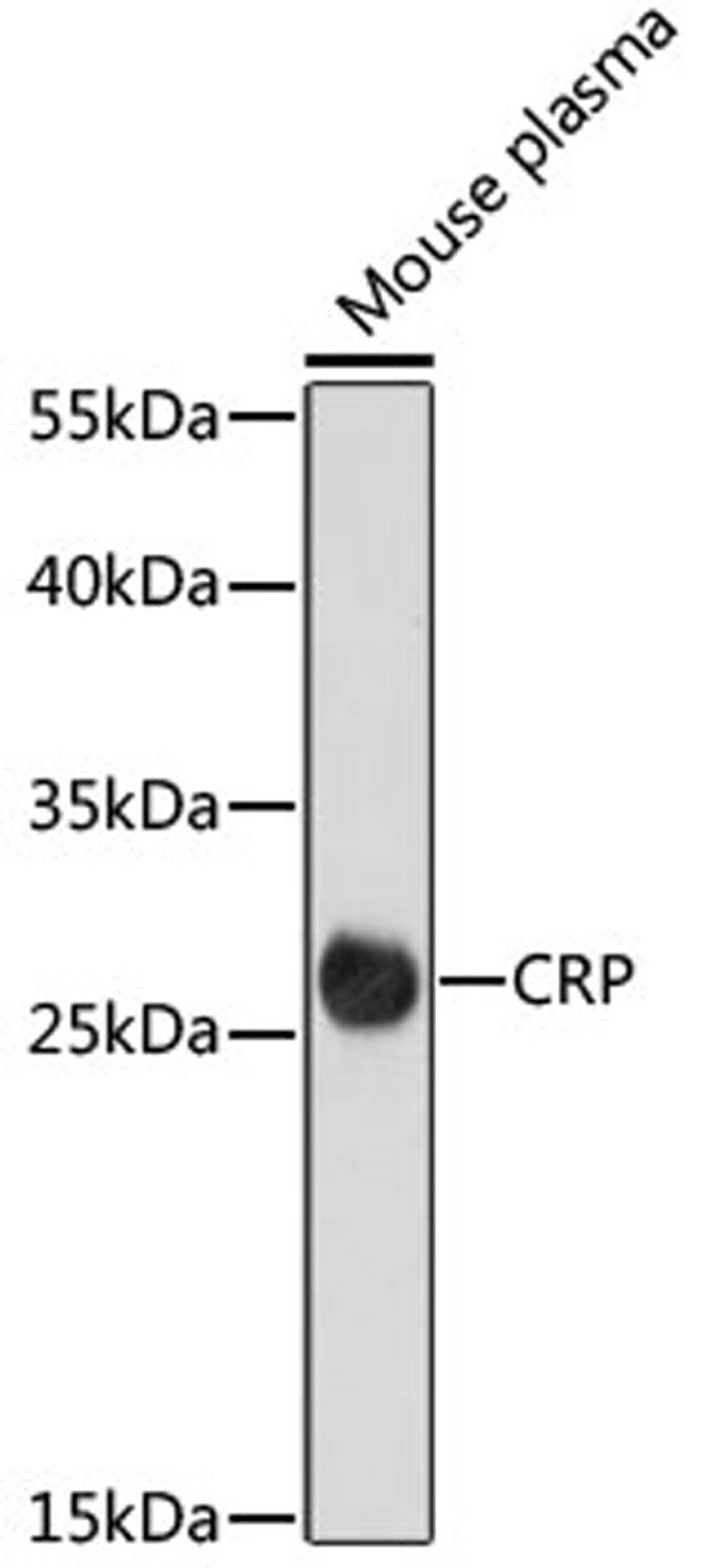 Western blot - CRP antibody (A15659)