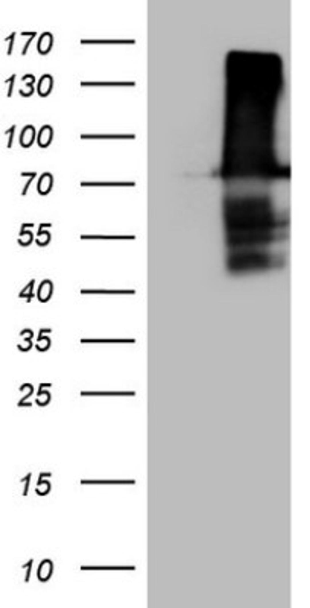 Western Blot: FERMT3/URP2 Antibody (3C7) [NBP2-45641] - Analysis of HEK293T cells were transfected with the pCMV6-ENTRY control (Left lane) or pCMV6-ENTRY FERMT3.