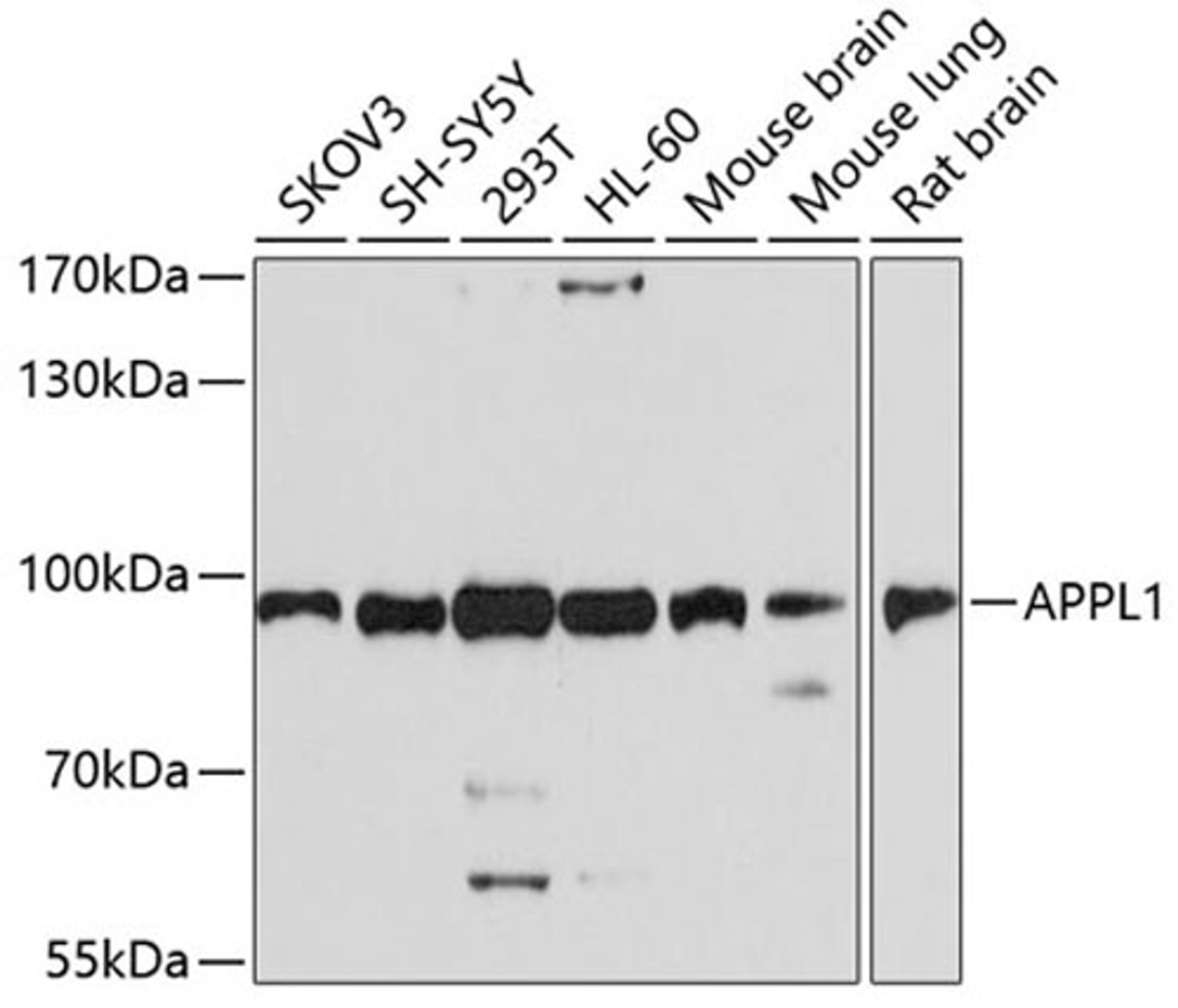 Western blot - APPL1 antibody (A4606)