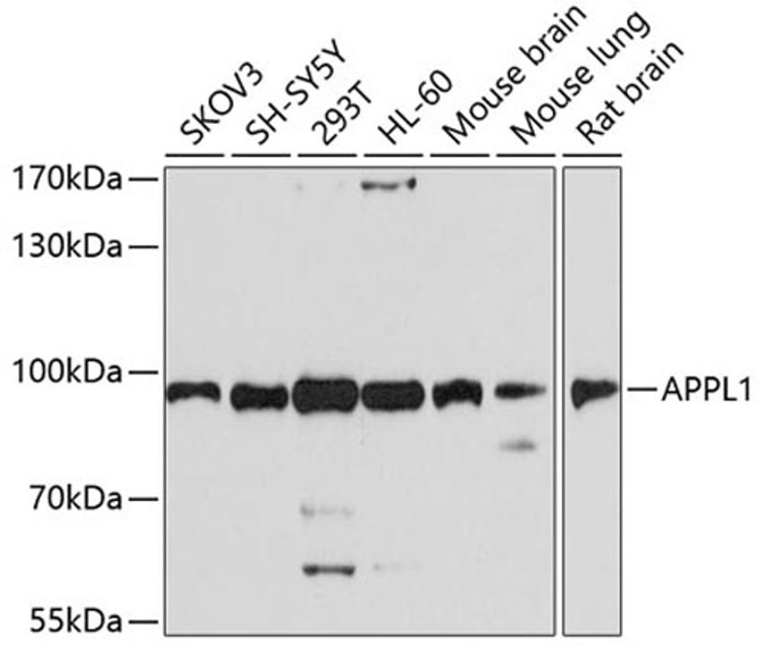 Western blot - APPL1 antibody (A4606)