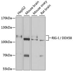 Western blot - RIG-I / DDX58 antibody (A13407)