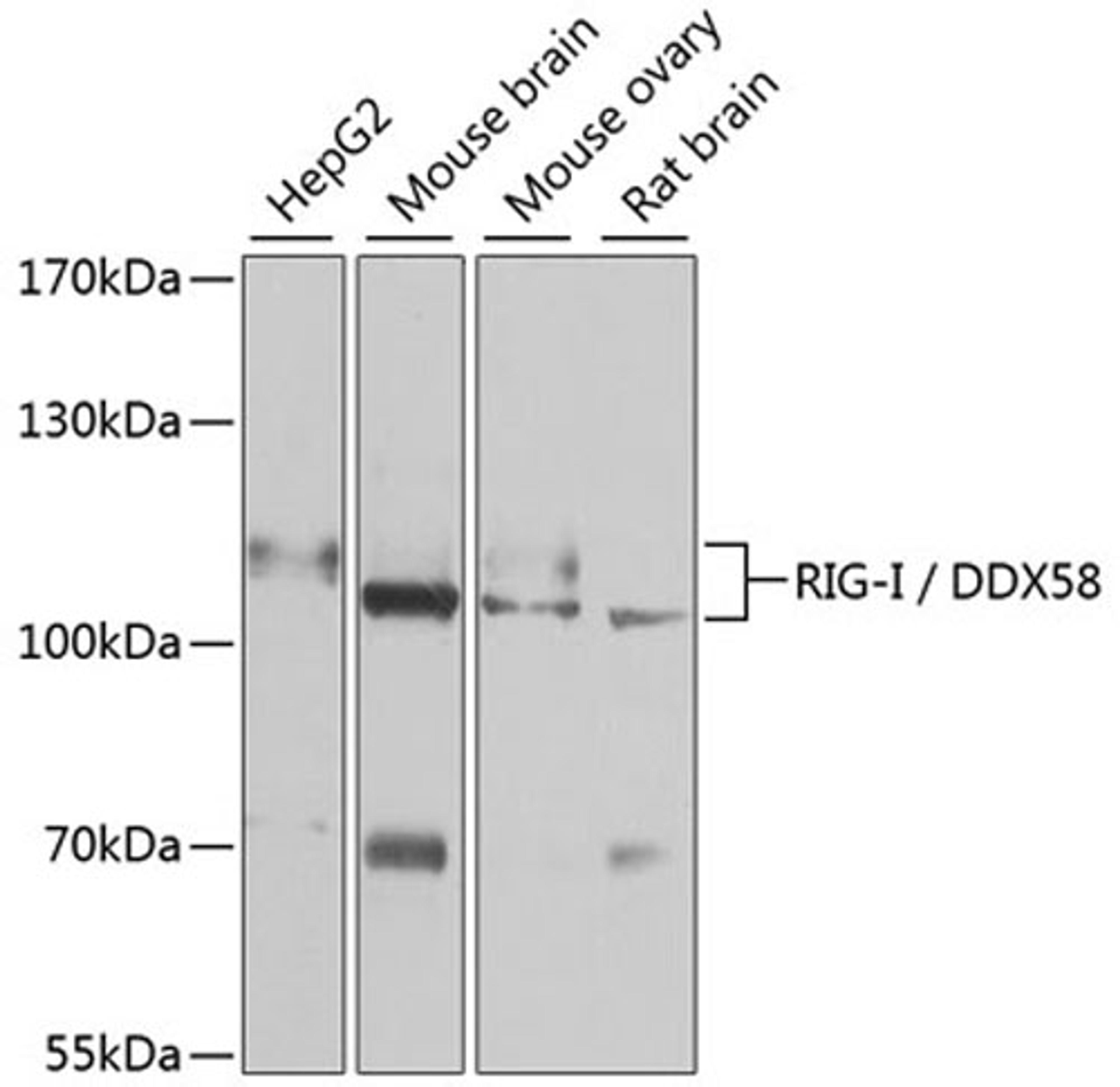 Western blot - RIG-I / DDX58 antibody (A13407)